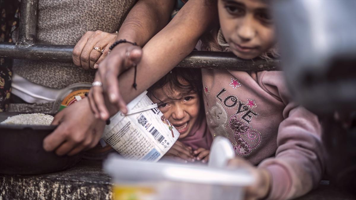 Gazze'de çocuklar yetersiz beslenme nedeniyle ölüyor