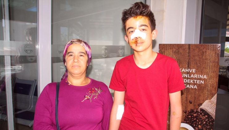 Antalya’da sahipsiz köpeklerden kaçarken otomobil çarpan genç yaralandı